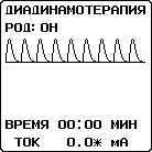диадинамотерапия