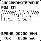 диадинамотерапия